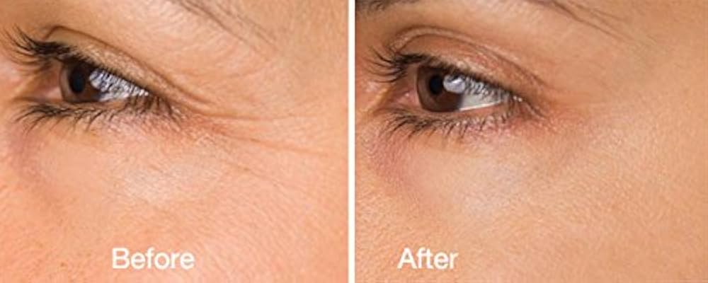 Amazon.com: DNA Code® NeuroPeptides Argireline Serum+